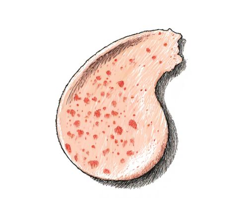Freckle Fading Strategies in Skincare: Ingredients, Methods, and Product Selection